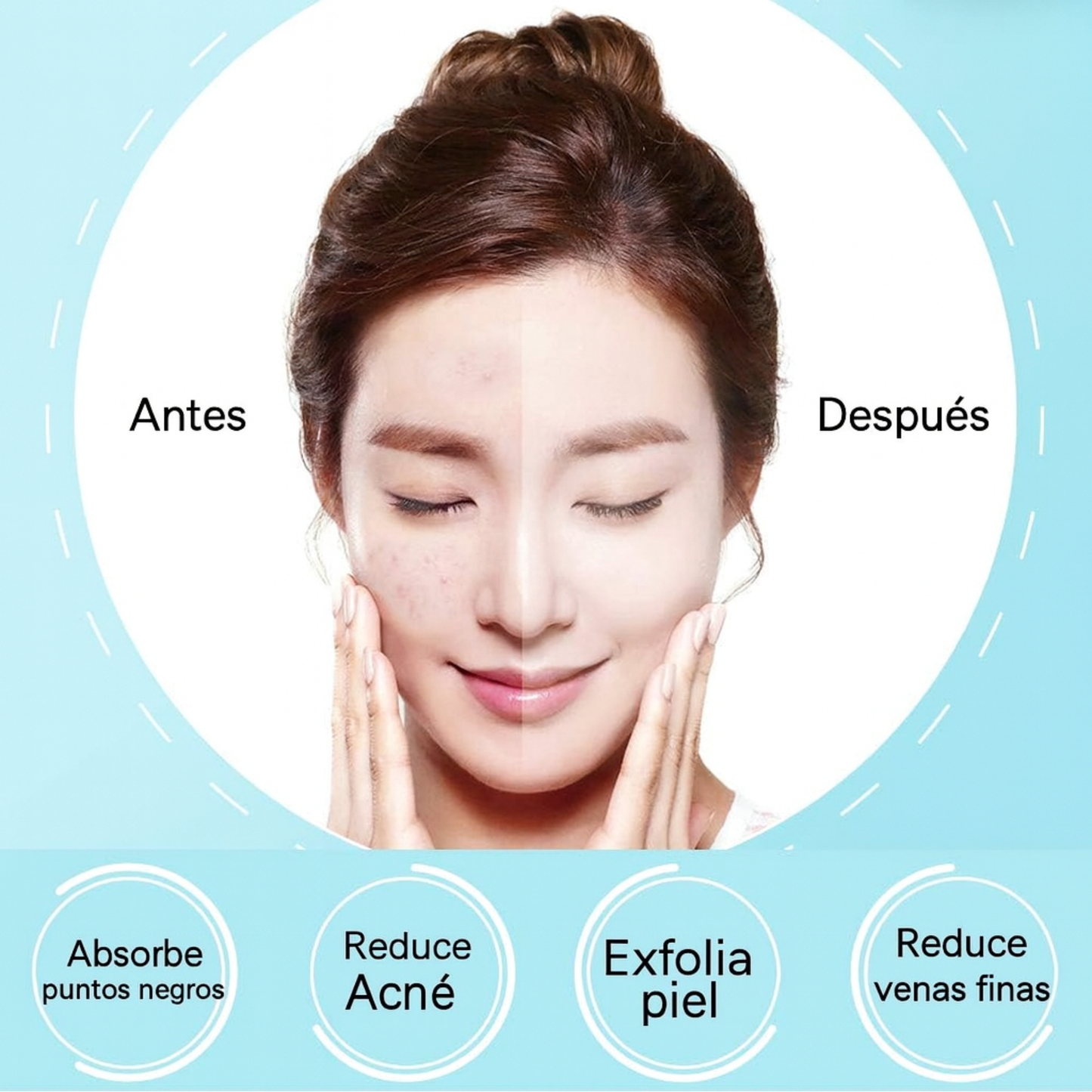 Extractor Puntos Negros Con Cabezales Removibles FlexShop