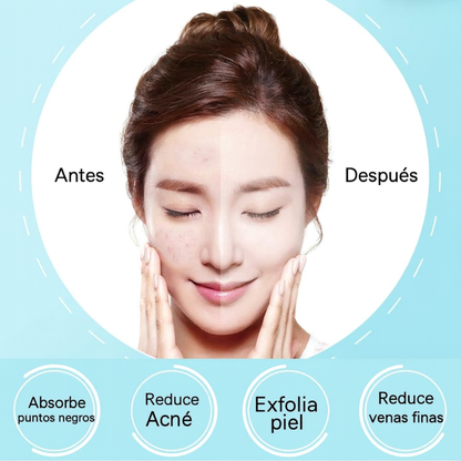 Extractor Puntos Negros Con Cabezales Removibles FlexShop